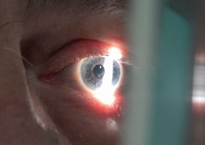 A macro view of an eye, a strip of bright white light intersects the iris, obscuring our view of the pupil.